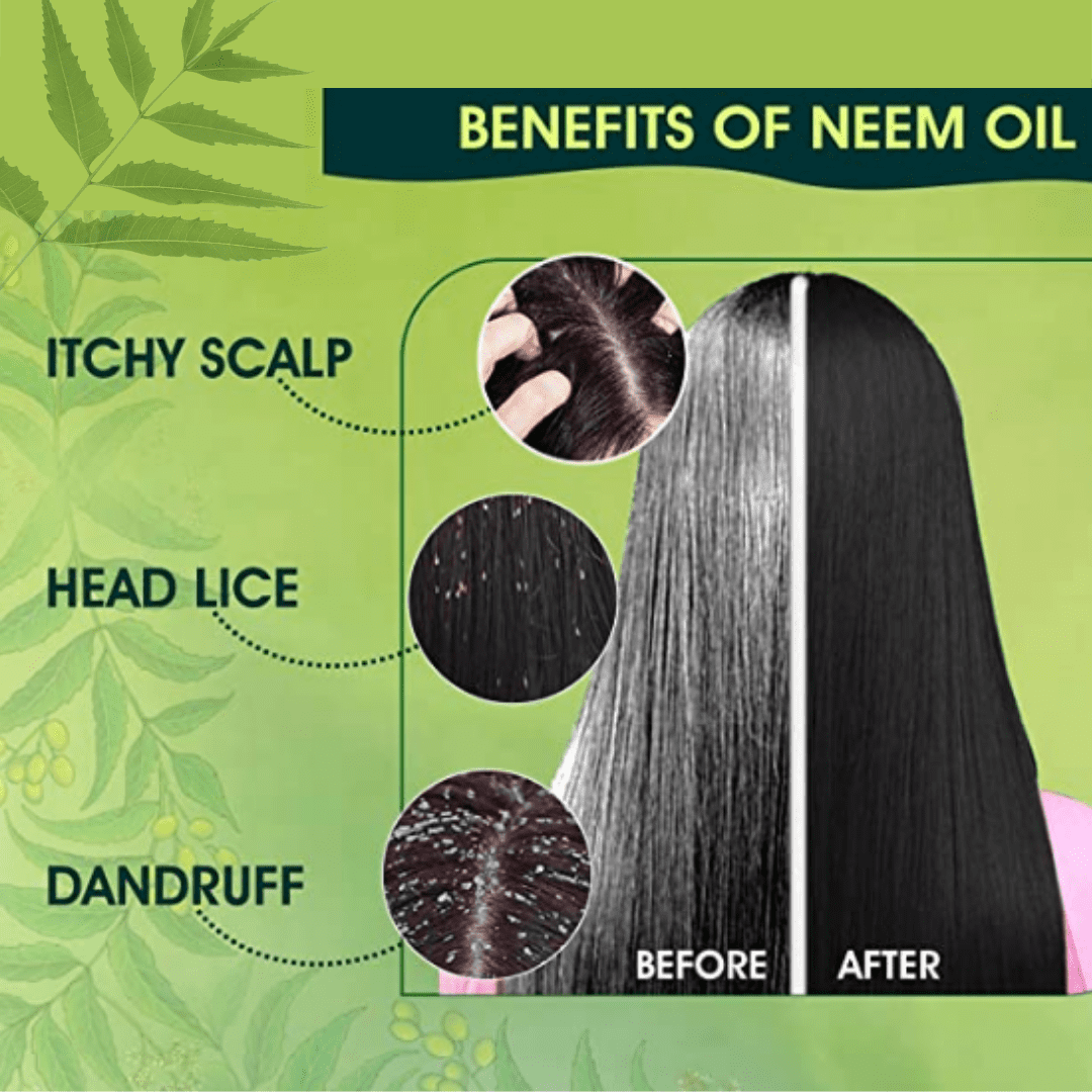 100% PURE NEEM OIL - FOR DANDRUFF FREE HAIR